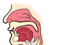 Health Tips on Chronic Sinusitis